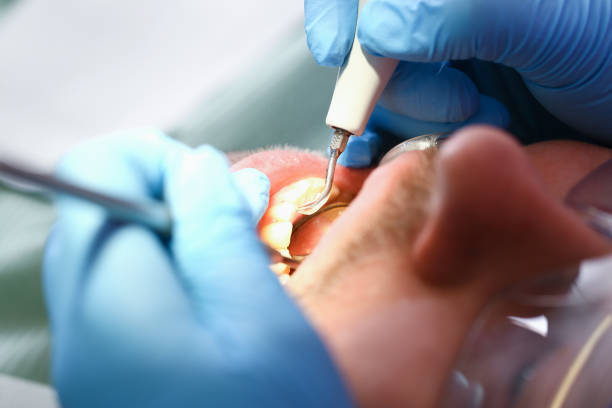 Best Emergency Denture Repair in Montague, MI