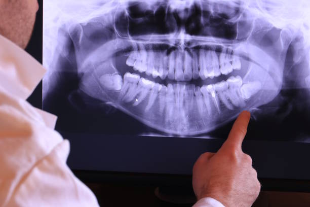 Best Emergency Denture Repair in Montague, MI